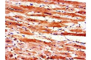 Immunohistochemistry of paraffin-embedded human heart tissue using ABIN7160397 at dilution of 1:100