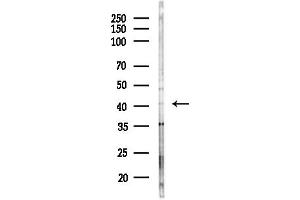 anti-G Protein-Coupled Receptor 4 (GPR4) (Internal Region) antibody