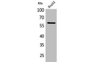 Western Blot analysis of HepG2 cells using HEXA Polyclonal Antibody (Hexosaminidase A 抗体  (Internal Region))