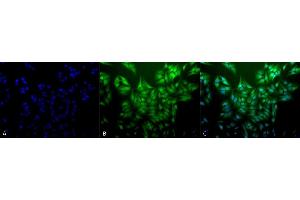 Immunocytochemistry/Immunofluorescence analysis using Mouse Anti-Ubiquitin Monoclonal Antibody, Clone 5B9-B3 (ABIN361810 and ABIN361811). (Ubiquitin 抗体)