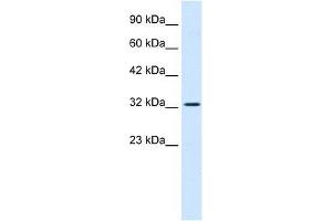 SMARCA2 antibody used at 0. (SMARCA2 抗体  (Middle Region))