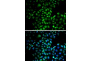Immunofluorescence analysis of HeLa cells using C11orf30 antibody (ABIN6290348). (EMSY 抗体)