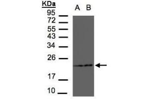 Figure 1. (RAMP2 抗体  (AA 111-175))