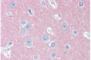 Human Brain, Cortex (formalin-fixed, paraffin-embedded) stained with THY1 antibody ABIN396935 at 10 ug/ml followed by biotinylated anti-mouse IgG secondary antibody ABIN481714, alkaline phosphatase-streptavidin and chromogen. (CD90 抗体)