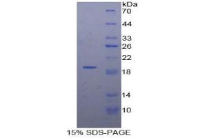 SDS-PAGE analysis of Human DVL1 Protein. (DVL1 蛋白)