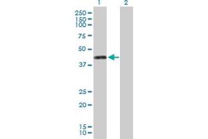 Western Blot analysis of PTDSS1 expression in transfected 293T cell line by PTDSS1 MaxPab polyclonal antibody. (PTDSS1 抗体  (AA 1-473))