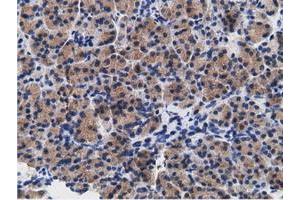 Immunohistochemical staining of paraffin-embedded Human colon tissue using anti-CD80 mouse monoclonal antibody. (CD80 抗体)