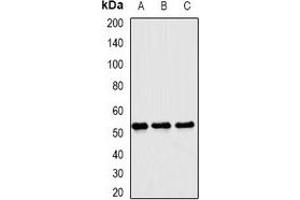 Western blot analysis of Matrilin 3 expression in mouse liver (A), mouse brain (B), rat liver (C) whole cell lysates. (Matrilin 3 抗体)