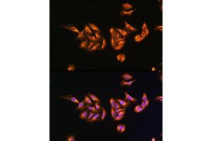 Immunofluorescence analysis of U-2 OS cells using MRPS27 Rabbit pAb  at dilution of 100 (40x lens). (MRPS27 抗体  (AA 255-414))