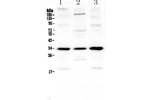 Western blot analysis of MyD88 using anti-MyD88 antibody . (MYD88 抗体  (AA 12-263))