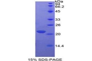 SDS-PAGE analysis of IL17 Protein. (IL-17 蛋白)