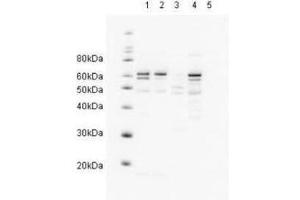 Western blot showing  Affinity Purified anti-HR23A antibody detects endogenous human HR23A.
