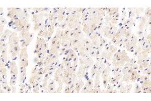 Detection of MYOM2 in Human Cardiac Muscle Tissue using Polyclonal Antibody to Myomesin 2 (MYOM2) (MYOM2 抗体  (AA 1130-1434))