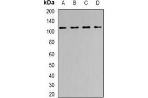 Western blot analysis of SNF2H expression in PC3 (A), HepG2 (B), mouse spleen (C), mouse brain (D) whole cell lysates. (SMARCA5 抗体)