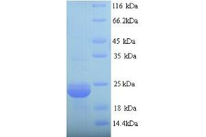 SDS-PAGE (SDS) image for YOAJ (AA 26-232) protein (ABIN5714286) (YOAJ (AA 26-232) 蛋白)
