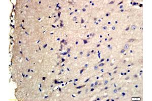 Formalin-fixed and paraffin embedded rat brain labeled with Rabbit Anti-TSC2(Ser1798) Polyclonal Antibody, Unconjugated (ABIN712121) at 1:200 followed by conjugation to the secondary antibody and DAB staining (Tuberin 抗体  (pSer1798))