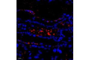 Immunofluorescence of paraffin embedded mouse placenta using DEPDC1 (ABIN7073717) at dilution of 1:500 (400x lens) (DEPDC1 抗体)