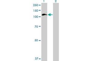 Western Blot analysis of HIP1 expression in transfected 293T cell line by HIP1 MaxPab polyclonal antibody. (HIP1 抗体  (AA 1-1037))