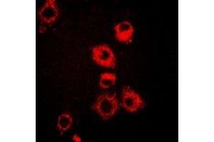 Immunofluorescent analysis of VAP-1 staining in A549 cells. (AOC3 抗体)