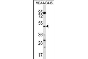 SNX4 Antibody (C-term) (ABIN656781 and ABIN2845999) western blot analysis in MDA-M cell line lysates (35 μg/lane). (Sorting Nexin 4 抗体  (C-Term))