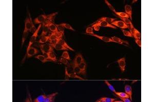 Immunofluorescence analysis of HeLa cells using PIK3CA Polyclonal Antibody at dilution of 1:100. (PIK3CA 抗体)