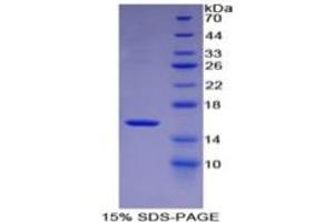 SDS-PAGE of Protein Standard from the Kit  (Highly purified E. (MBL2 ELISA 试剂盒)