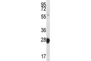 RAB27B antibody western blot analysis in MDA-MB435 lysate. (RAB27B 抗体  (AA 121-150))