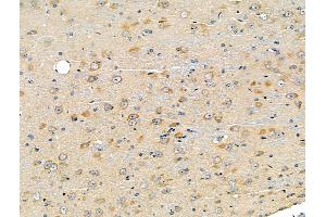 ABIN6260870 and ABIN6266837 at 1/100 staining Mouse brain tissue by IHC-P.