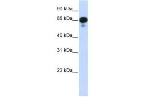 PPM1J antibody used at 1 ug/ml to detect target protein. (PPM1J 抗体)