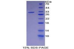 SDS-PAGE analysis of Mouse Smad6 Protein. (SMAD6 蛋白)
