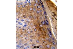 Formalin-fixed and paraffin-embedded human skin reacted with KRT10 Antibody , which was peroxidase-conjugated to the secondary antibody, followed by DAB staining. (Keratin 10 抗体  (AA 318-346))