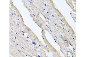 Immunohistochemistry of paraffin-embedded Rat heart using RCN2 Polyclonal Antibody at dilution of 1:100 (40x lens). (RCN2 抗体)