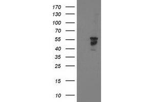 Western Blotting (WB) image for anti-Beclin 1, Autophagy Related (BECN1) antibody (ABIN1496867)