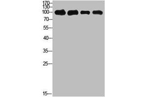 Western Blot analysis of 1,mouse-kidney 2,mouse-heart 3,3T3 4,Hela cells using primary antibody diluted at 1:500(4 °C overnight). (ACO2 抗体  (AA 421-470))