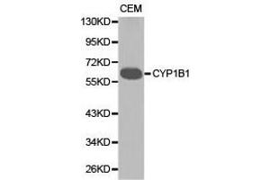 Western Blotting (WB) image for anti-Cytochrome P450, Family 1, Subfamily B, Polypeptide 1 (CYP1B1) antibody (ABIN1872164) (CYP1B1 抗体)