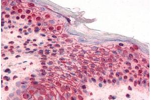Human Skin (formalin-fixed, paraffin-embedded) stained with GLI2 antibody ABIN351530 at 5 ug/ml followed by biotinylated goat anti-rabbit IgG secondary antibody ABIN481713, alkaline phosphatase-streptavidin and chromogen. (GLI2 抗体  (AA 46-60))
