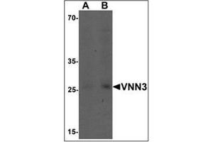 Western blot analysis of VNN3 in human brain tissue lysate with VNN3 Antibody  at (A) 0. (VNN3 抗体  (C-Term))
