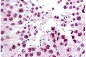 Human Testis: Formalin-Fixed, Paraffin-Embedded (FFPE) (SIRT1 抗体  (AA 456-555))