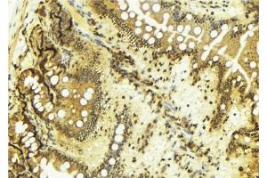 ABIN6269045 at 1/100 staining Mouse colon tissue by IHC-P.