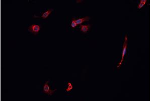 ABIN6268814 staining K-562 cells by IF/ICC. (KEAP1 抗体)