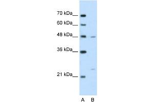 WB Suggested Anti-BSDC1 Antibody Titration:  2. (BSDC1 抗体  (N-Term))