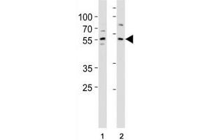 Western Blotting (WB) image for anti-Kruppel-Like Factor 4 (Gut) (KLF4) (AA 394-421) antibody (ABIN3031570)