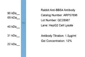 WB Suggested Anti-BBS4  Antibody Titration: 0. (BBS4 抗体  (Middle Region))