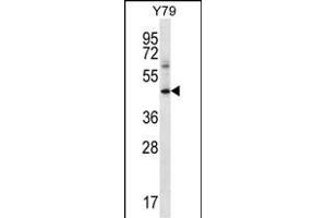 IFNGR1 Antibody (C-term) (ABIN656579 and ABIN2845842) western blot analysis in Y79 cell line lysates (35 μg/lane). (IFNGR1 抗体  (C-Term))
