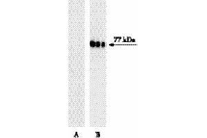 Western blot analysis of Btk (pY551) in human Burkitt’s lymphoma. (Btk and Itk (pTyr551) 抗体)