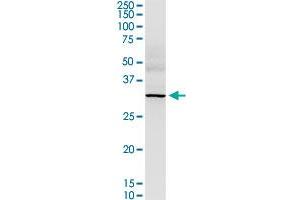 Western Blotting (WB) image for anti-three Prime Repair Exonuclease 1 (TREX1) (AA 1-369) antibody (ABIN524703)