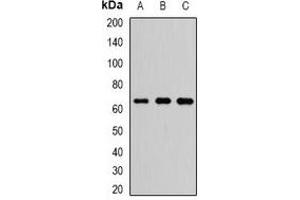 Western blot analysis of FXR1 expression in HepG2 (A), Hela (B), SW480 (C) whole cell lysates. (FXR1 抗体)