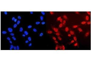 IF analysis of NF1 using anti-NF1 antibody (ABIN7600195).