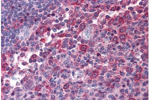 Human Tonsil: Formalin-Fixed, Paraffin-Embedded (FFPE) (Cytohesin 1 抗体  (AA 1-399))