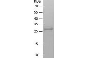 RPA2 Protein (AA 1-270) (His tag)